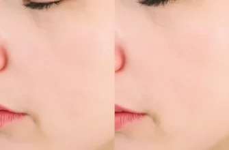 A split-screen before-and-after image showing the effects of the Ole Henriksen Cold Plunge Pore Mask: on the left, a close-up of facial skin with visible enlarged pores, slight redness, and dull texture; on the right, the same area of skin after use, appearing smoother, with visibly minimized pores, reduced redness, and a radiant, refreshed complexion. The lighting is soft and even, highlighting skin texture without harsh shadows. The background is neutral and clean to keep focus on the skin tra